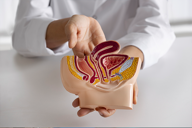 Colon cancer Keyhole surgery