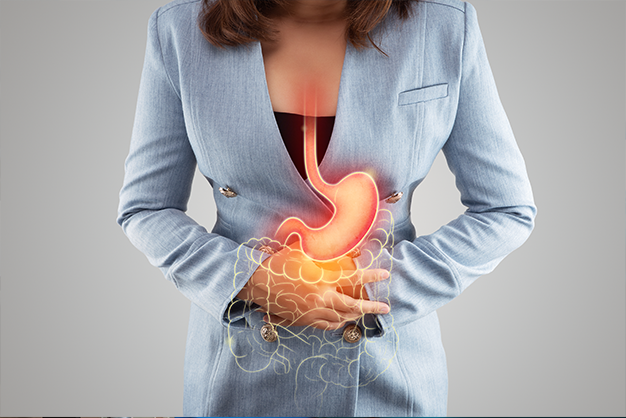 GERD Gastroesophageal Reflux Disease
