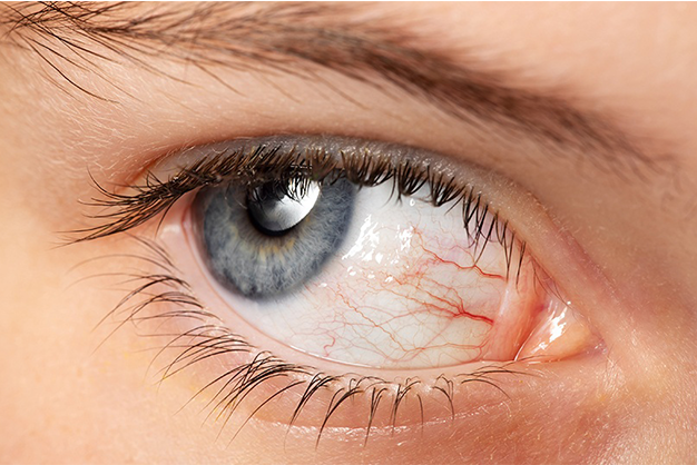 Ocular Surface Diseases: From Conjunctivitis to Keratitis