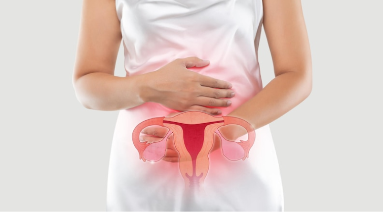 Polycystic Ovary Syndrome (PCOS): Causes, Symptoms, and Treatments